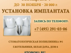 Скидка 15 000 рублей на установку имплантатов